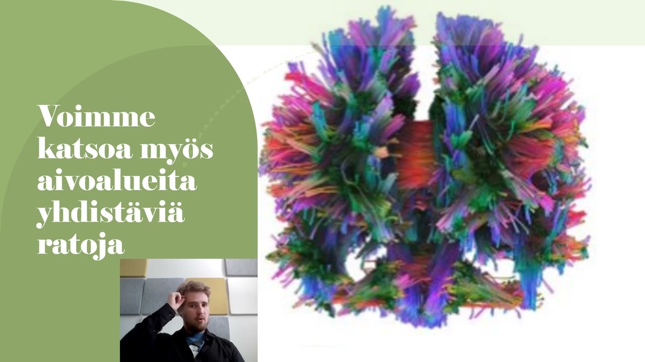 FinnBrain aivokuvantamistiimi esittelee toimintaansa