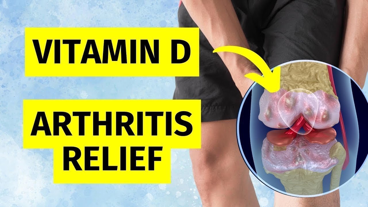 Vitamin D Supplement for Joint Pain - What Science ACTUALLY Says