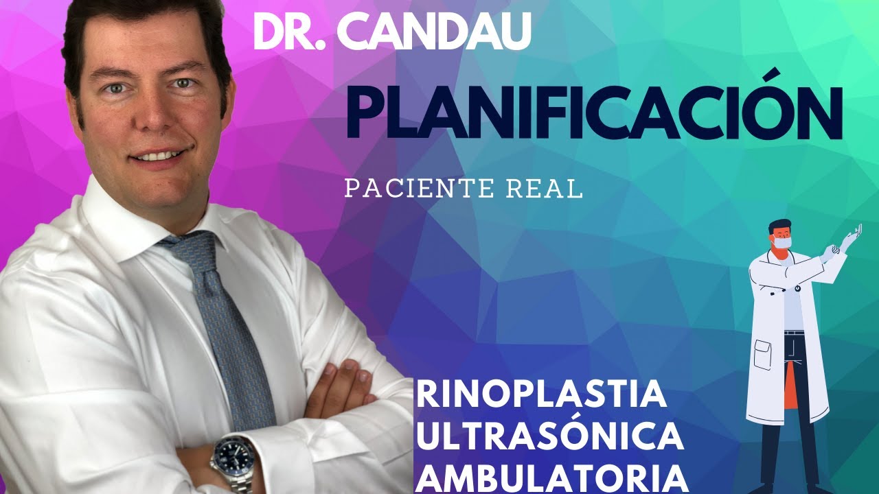 Asi planificamos una Rinoplastia Ultrasónica - Dr Candau
