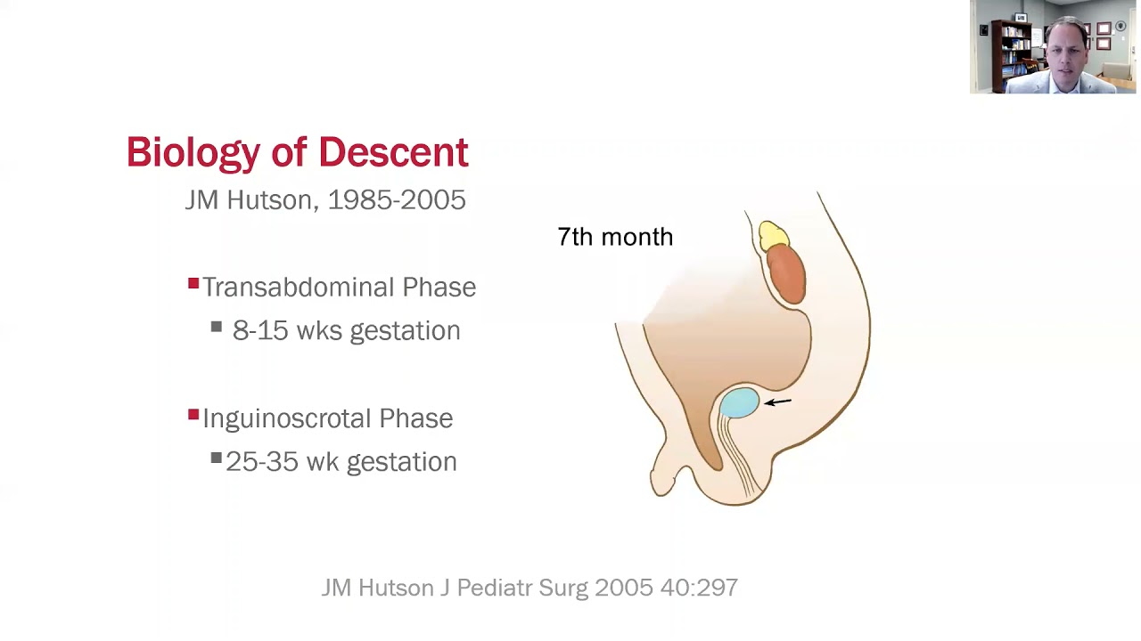 Pediatric Inguinal Hernia and Scrotal Conditions    Dr  Alan Ladd