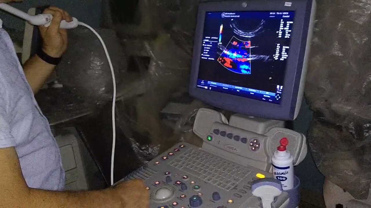 Testing Logiq P5 with convex + TV probe