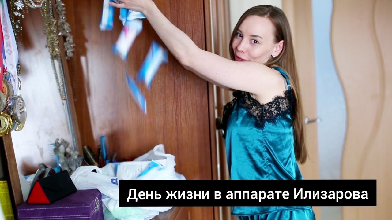 Из тяжелоатлета в инвалида. Как жить в аппарпре Илизарова? Как ходить и одеваться в аппарате?