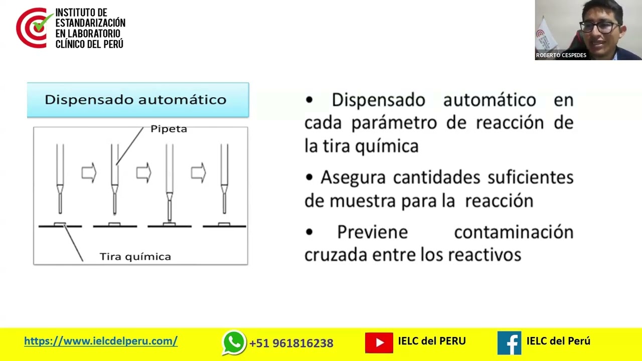 Automatización en uroanálisis
