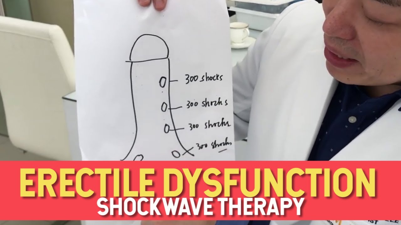 ERECTILE DYSFUNCTION SHOCKWAVE THERAPY | NON-INVASIVE | ED1000