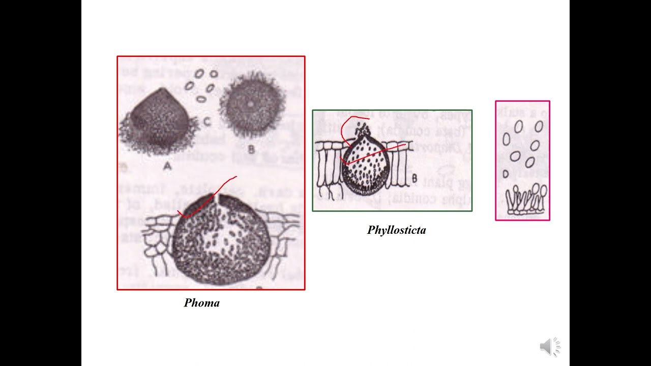 Class Coelomycetes