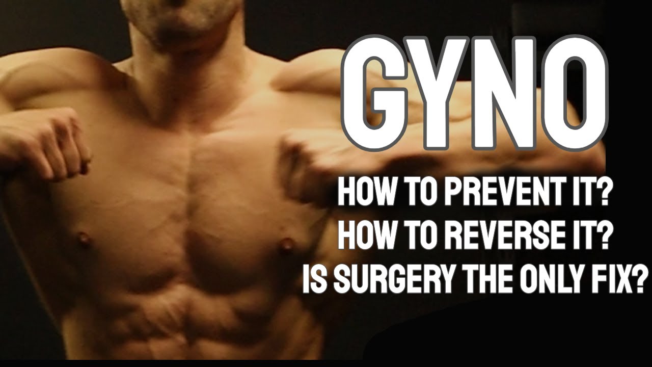 Gynecomastia  for Bodybuilders | Do you need surgery or can your gyno be reversed?