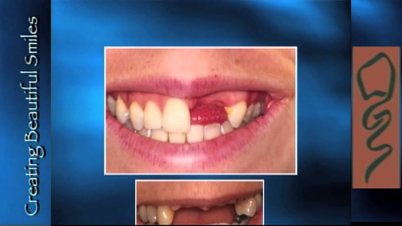 Welcome to the Beverly Hills Center for Aesthetic and Restorative Dentistry