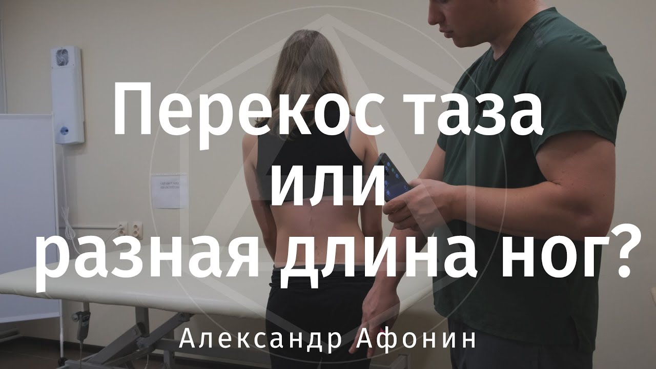 Перекос таза или разные ноги, как самостоятельно ответить на вопрос. Пример измерений на пациентке.