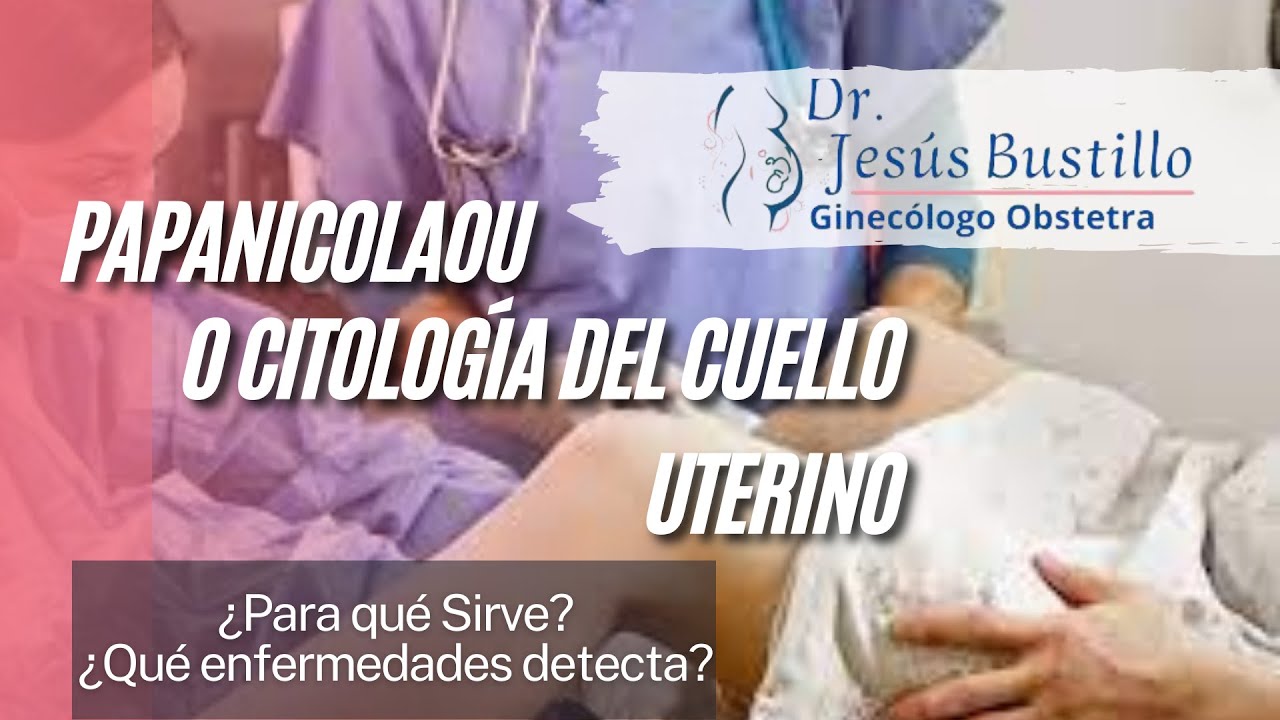 ¿Qué es la prueba de Papanicolaou? Y Para qué sirve