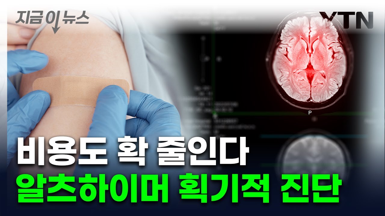 [지금이뉴스] 간단한 피검사로 알츠하이머 진단...FDA 첫 승인 / YTN
