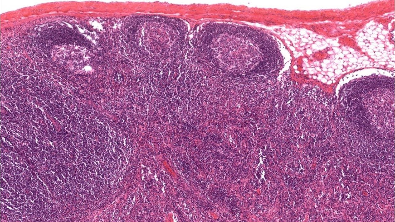 Histología del Sistema linfoide CAPÍTULO 10