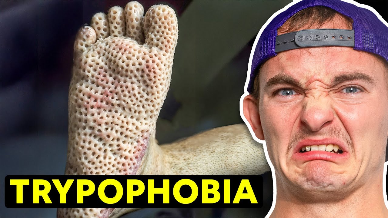 World's Weirdest Fears Exposed