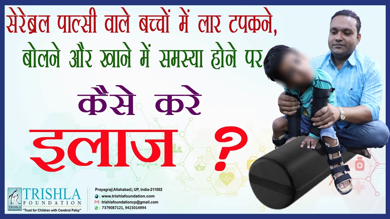 Management of Drooling, Problem in Speech & Feeding in Cerebral Palsy Children | Trishla Foundation