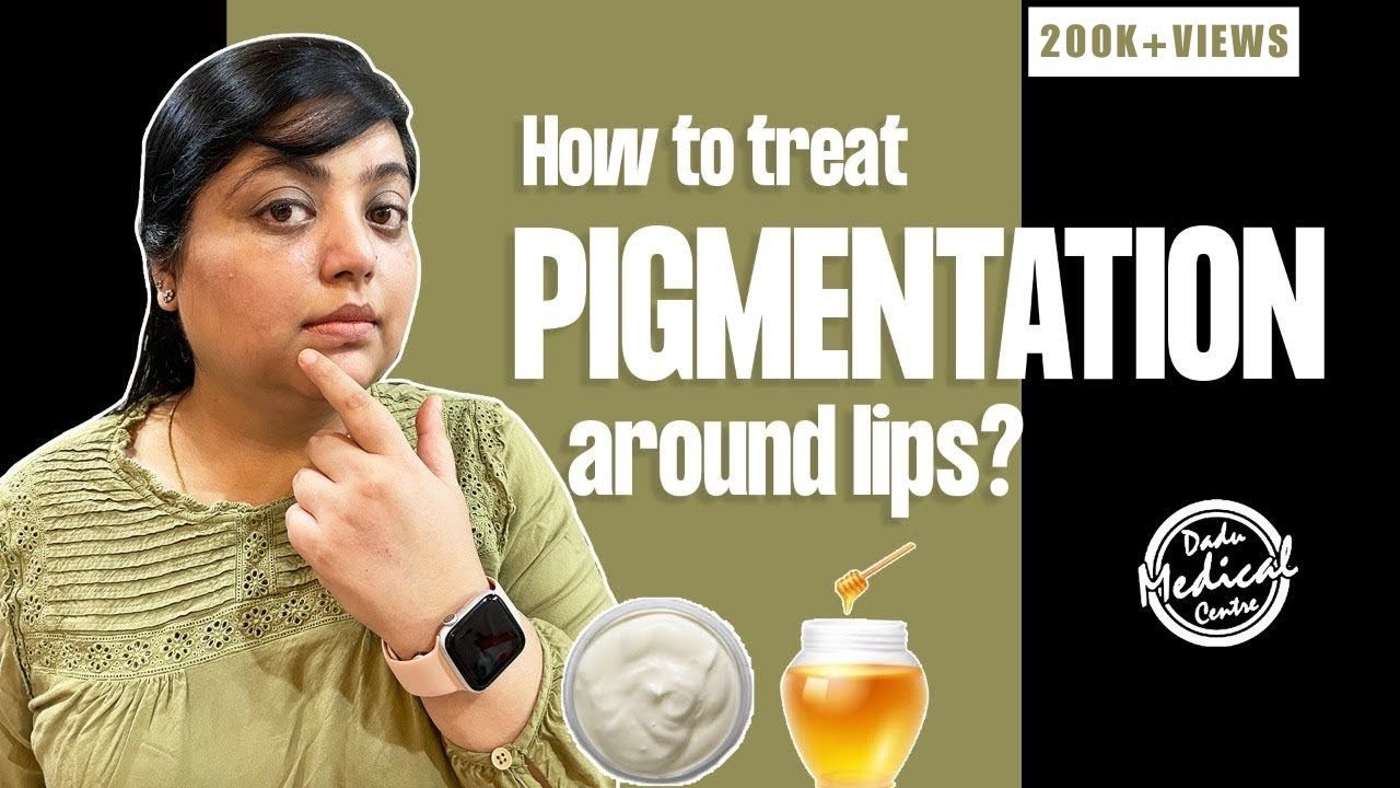 How to treat PIGMENTATION around the MOUTH / LIPS | Home Remedies, Creams and Treatments (हिंदी में)