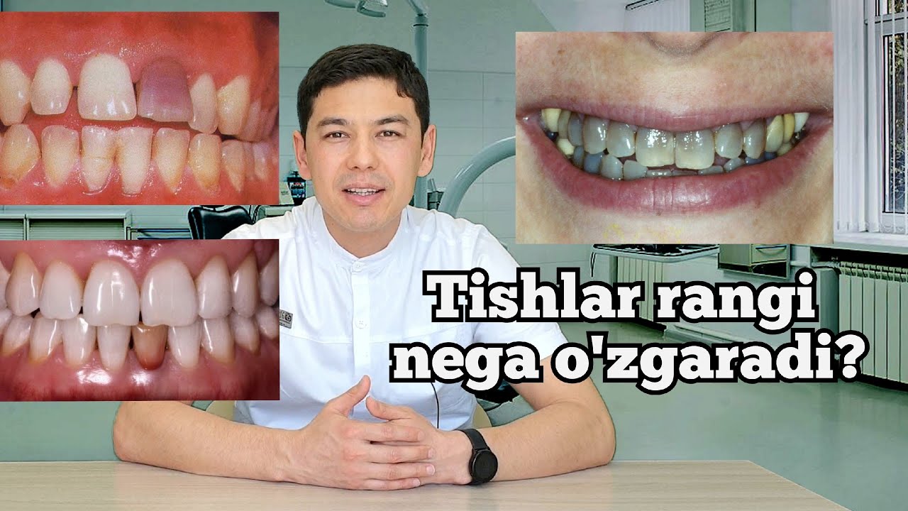 TISHLAR RANGI NEGA O'ZGARADI?    ТИШЛАР РАНГИ НЕГА УЗГАРАДИ?