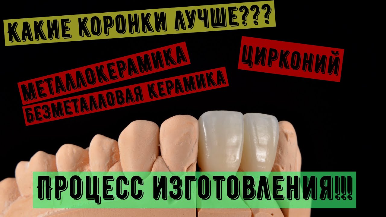 Какие коронки на зубы лучше? Металлокерамика, Цирконий, emax. Процесс работы. Изготовление коронок.