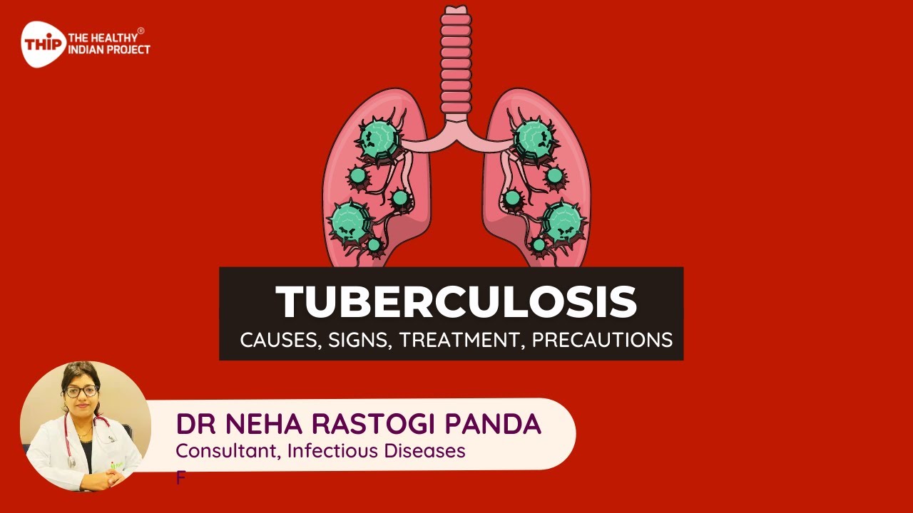 The TB Epidemic: Causes, Symptoms, Treatment