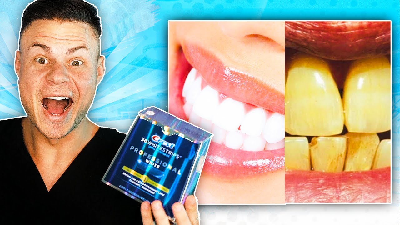 Whiten Your Teeth With Braces