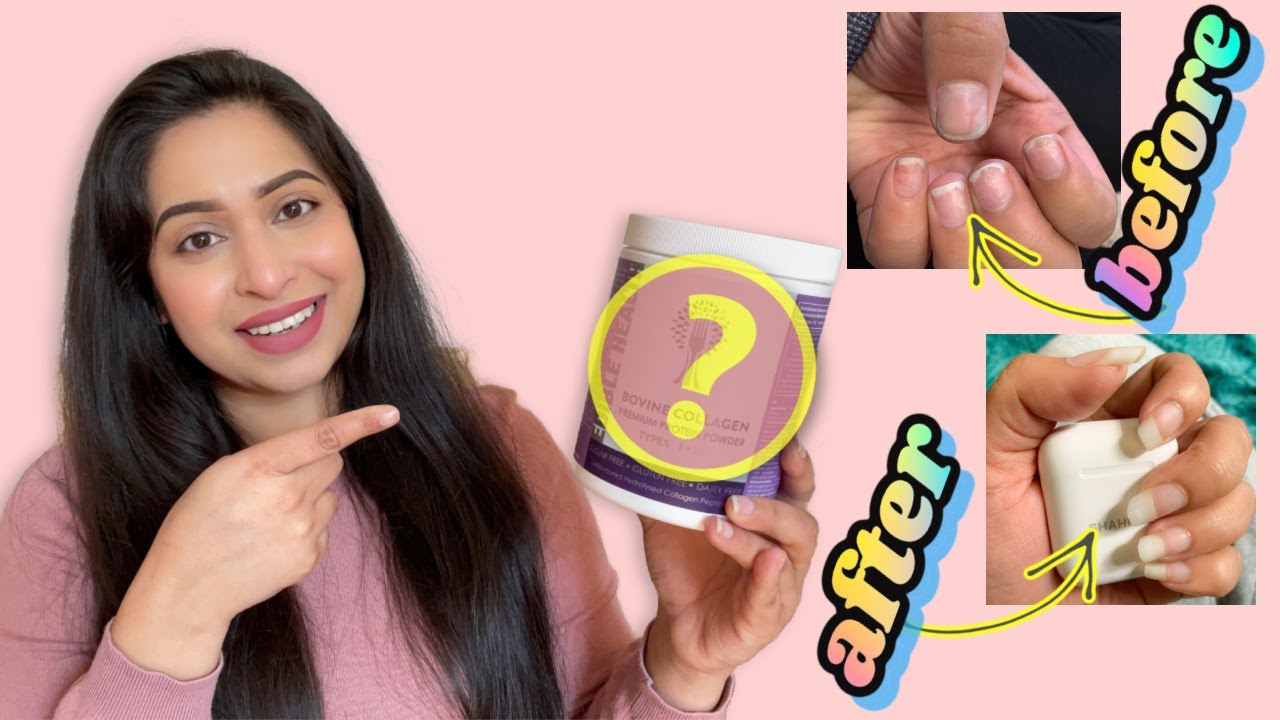 চুল, ত্বক, নখ, হাড় ভালো রাখতে দেড়বছর ধরে আমি যা খাচ্ছি | COLLAGEN POWDER REVIEW - SHAHNAZ SHIMUL