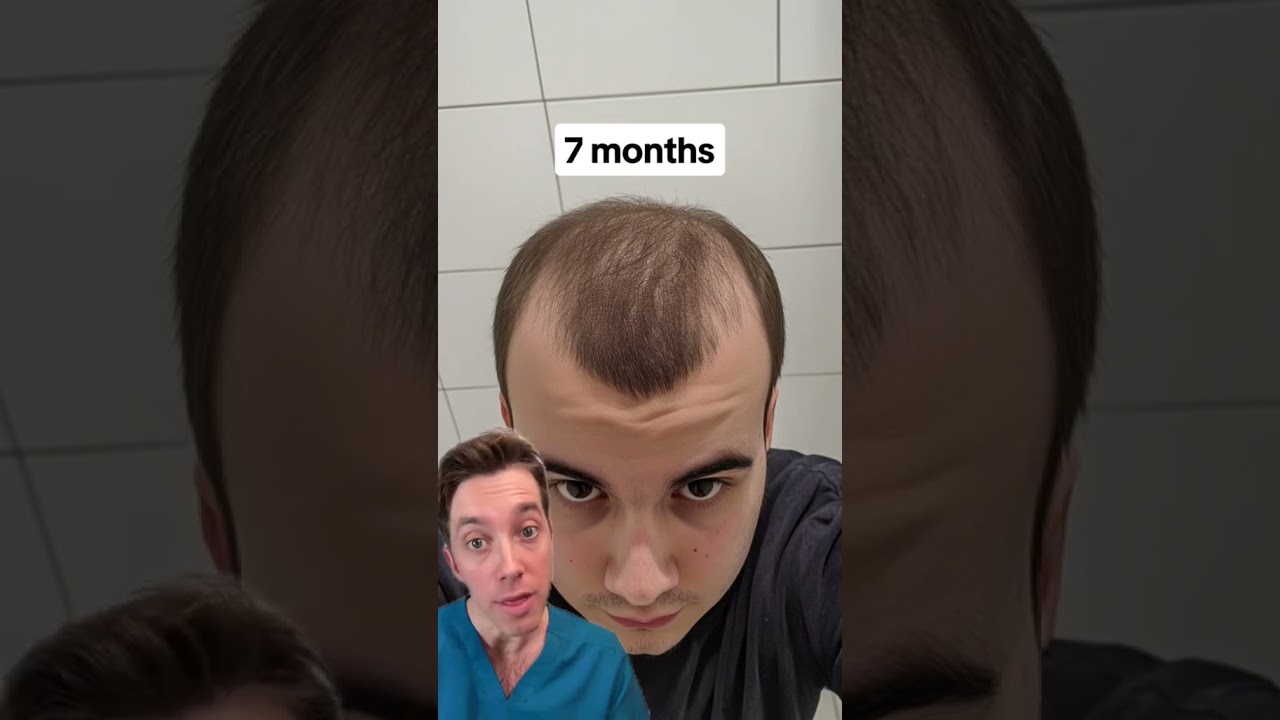 Calling BS on &ldquo;Just Minoxidil&rdquo;?