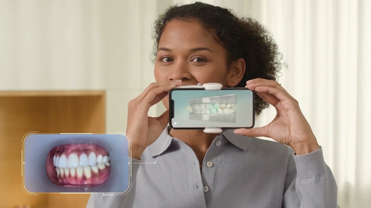How to scan with your ScanBox Pro - ScanAssist Aligners - Japanese