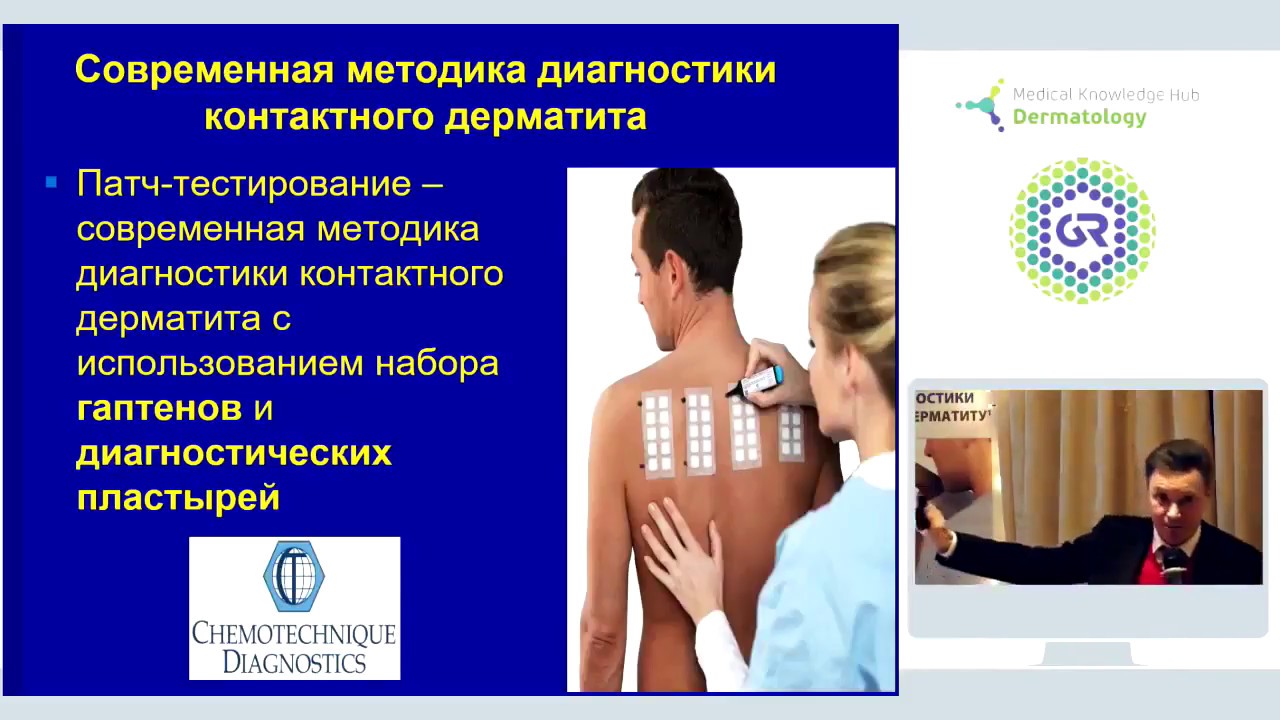 Рrick-тест vs. patch-тест: в чем разница?