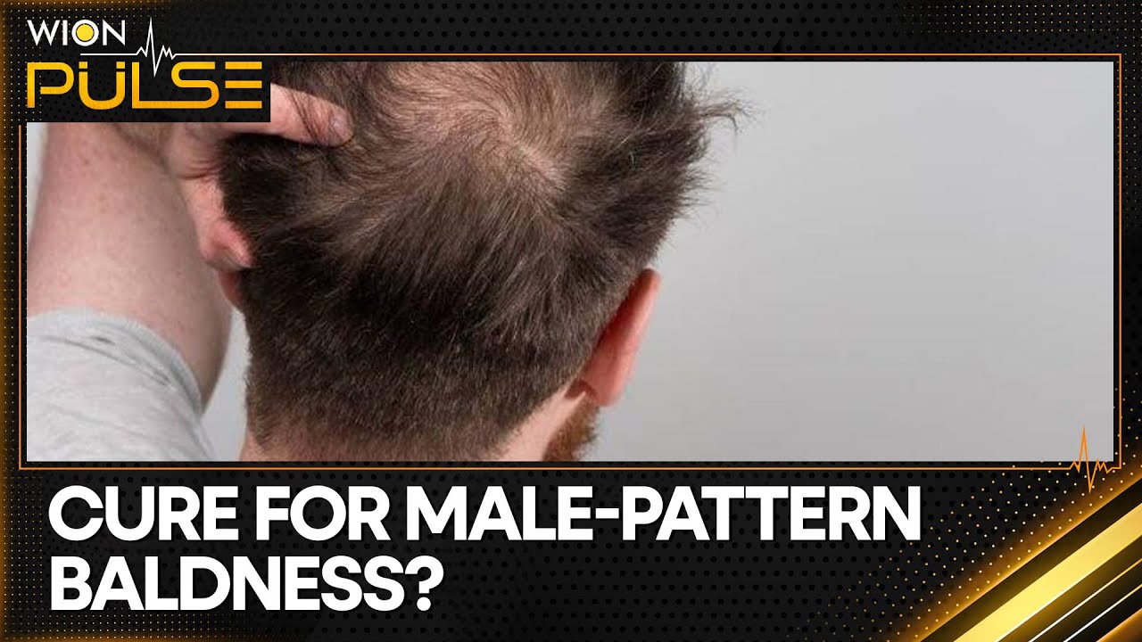 Clascoterone Brings Fresh Hopes, Delivers 539% Boost in Hair-Growth | WION Pulse