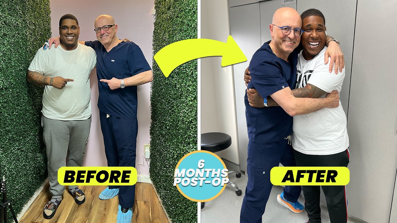 SIX MONTH ORBERA GASTRIC BALLOON TESTIMONIAL