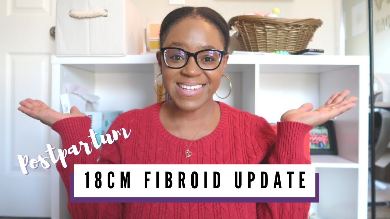 PREGNANT with FIBROIDS | My VAGINAL DELIVERY Experience & Update on 18cm Fibroid | TheFortitudeFix