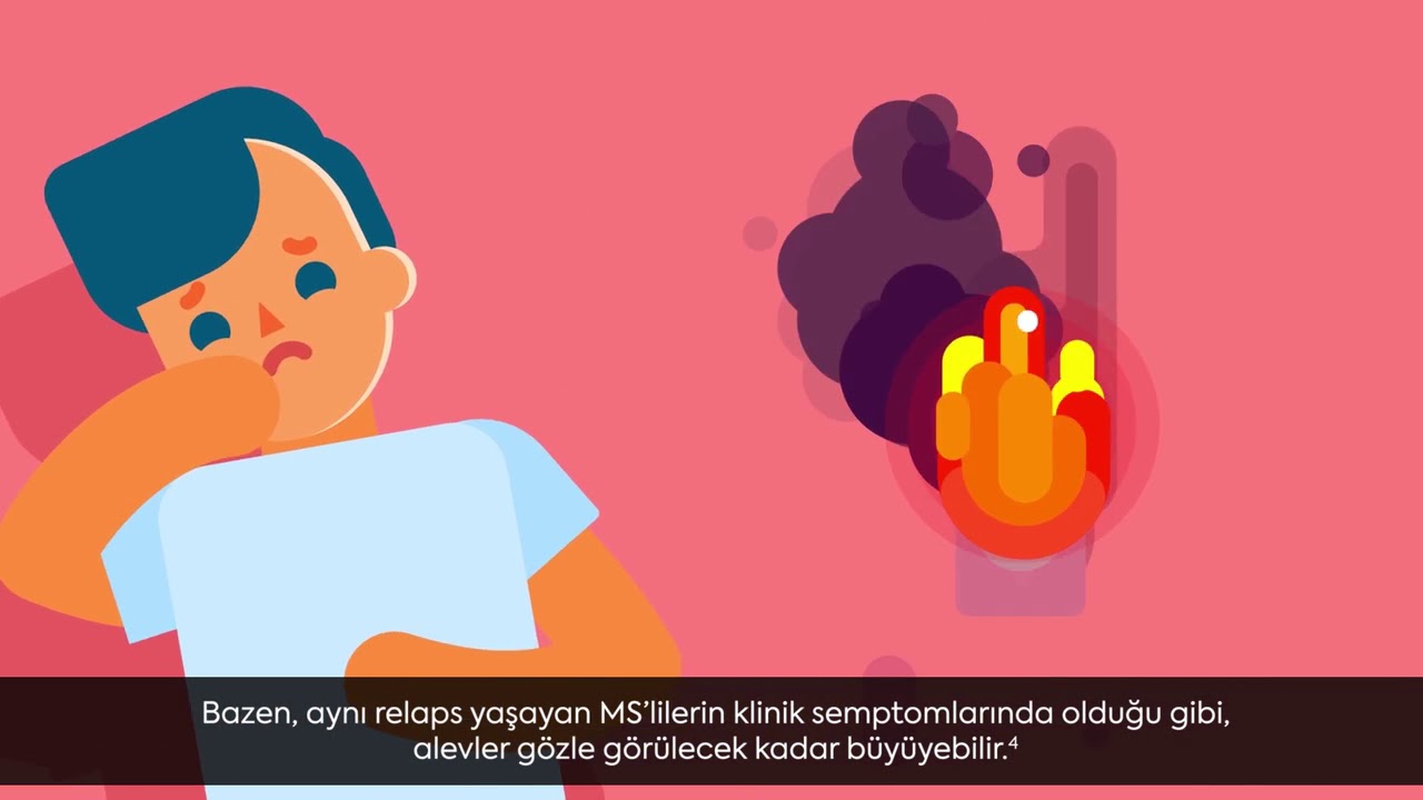 MS Nedir? | MS ve Hastalık Aktivitesi