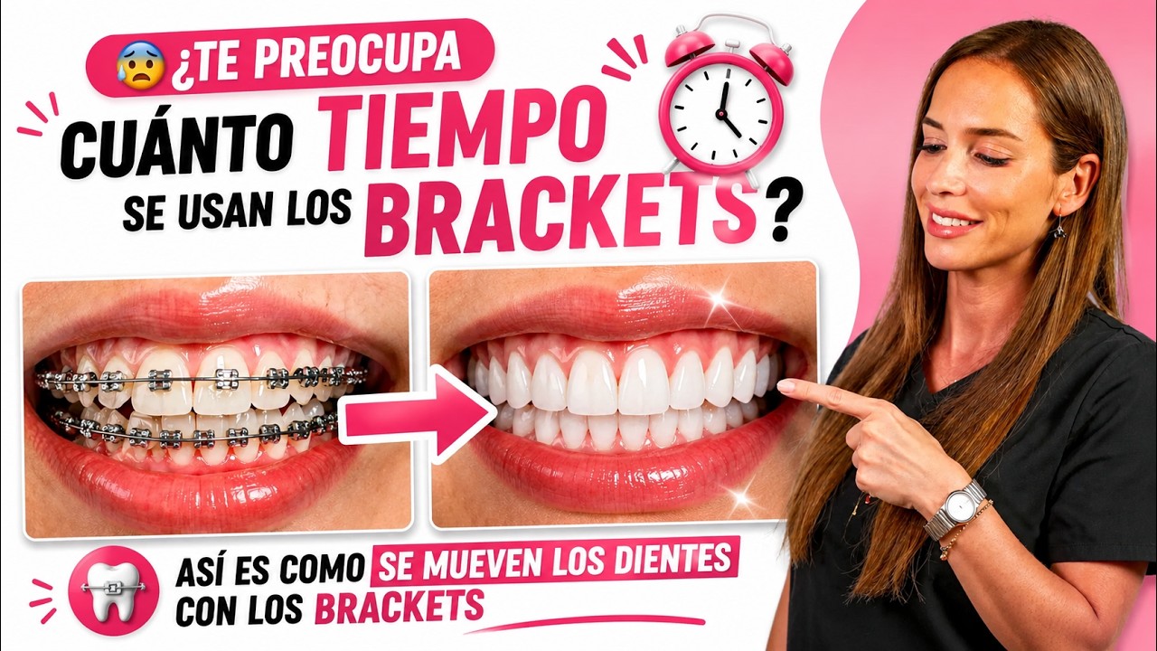 😰¿TE PREOCUPA cuanto TIEMPO se usan los BRACKETS? Así es como se MUEVEN LOS DIENTES con los Brackets
