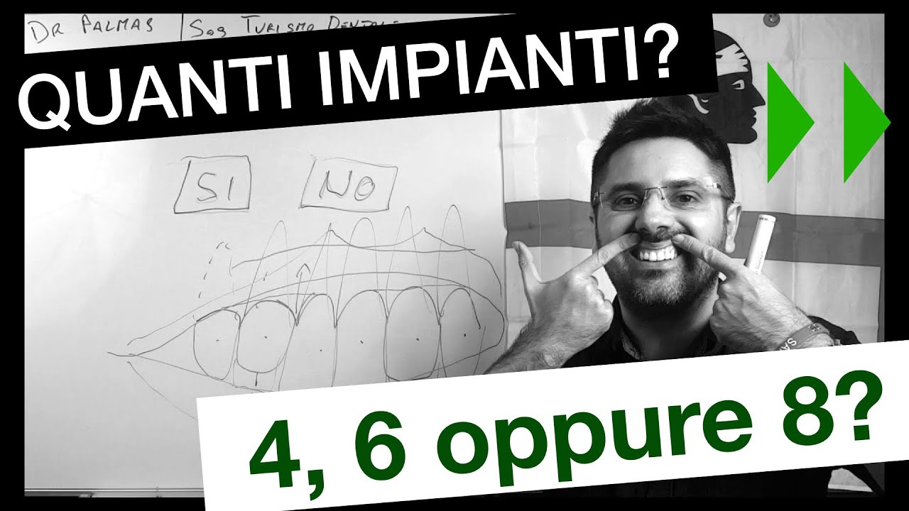 Dr Palmas, quanti impianti bisogna mettere nella bocca del paziente?