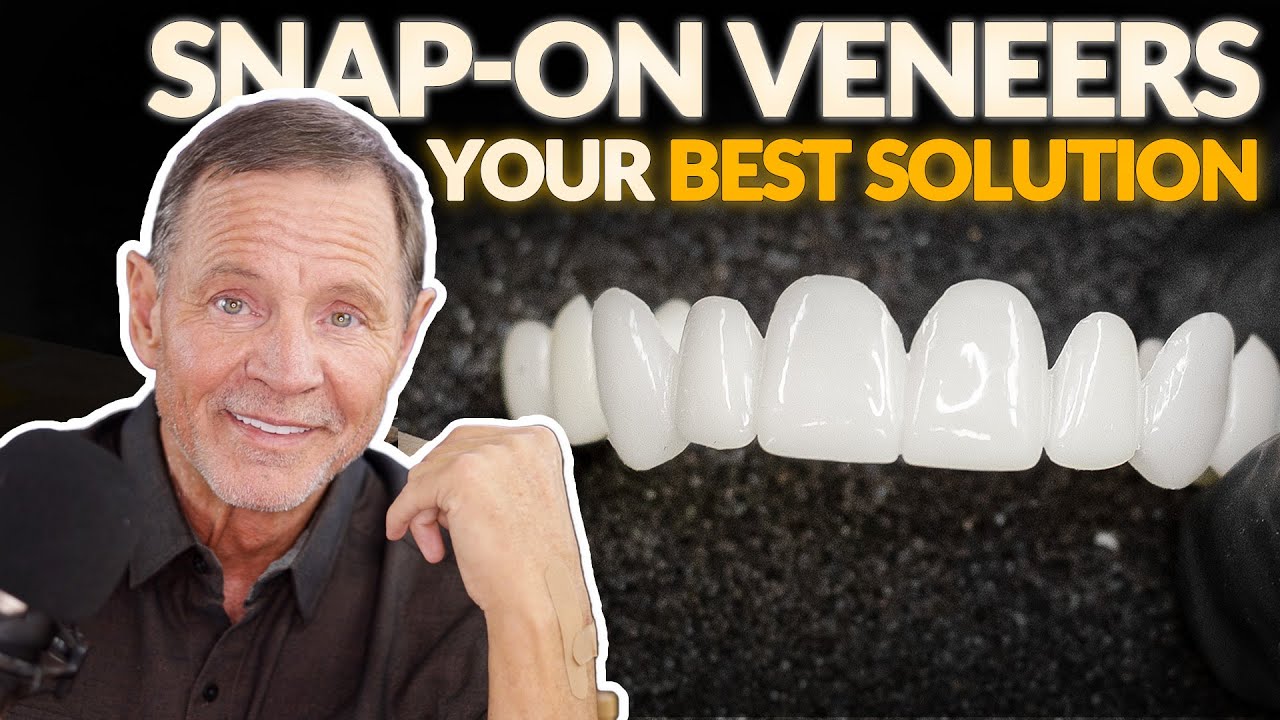 Smile Makeover Results Our Snap-on Veneer is Your BEST Solution!