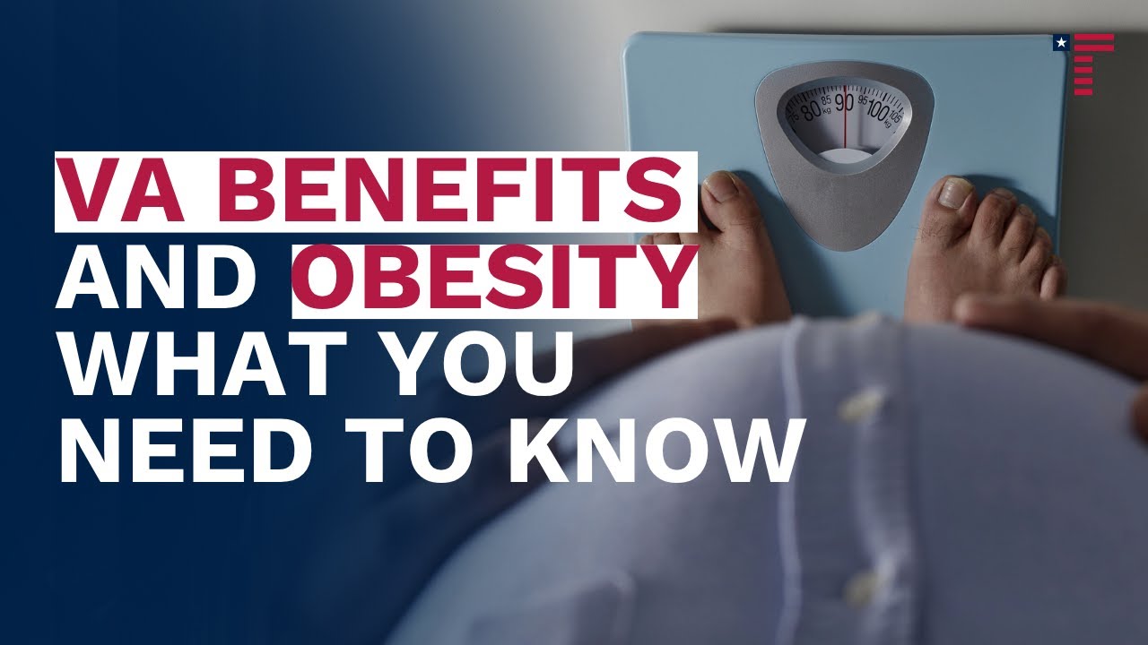 Service Connection for Obesity & Related Conditions | Unlock More VA Benefits