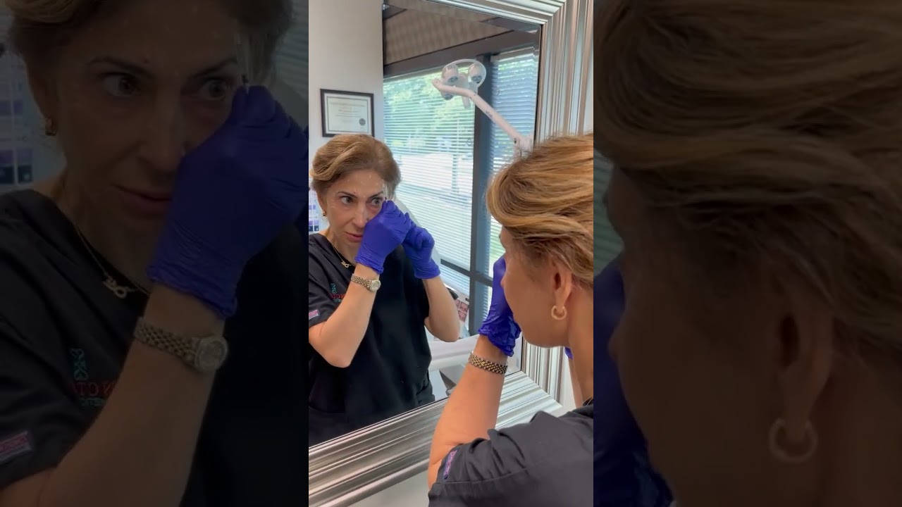 Watch Dr. Soheila Rostami perform her own Botox injections – step-by-step!