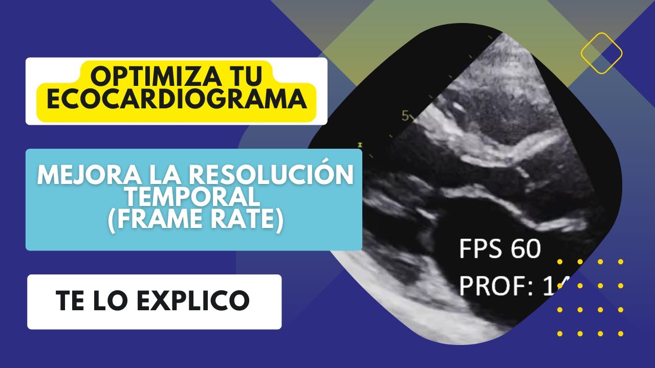 ✅OPTIMIZA TU ECOCARDIOGRAMA: 🔊Mejora la Resolución Temporal (Frame Rate)