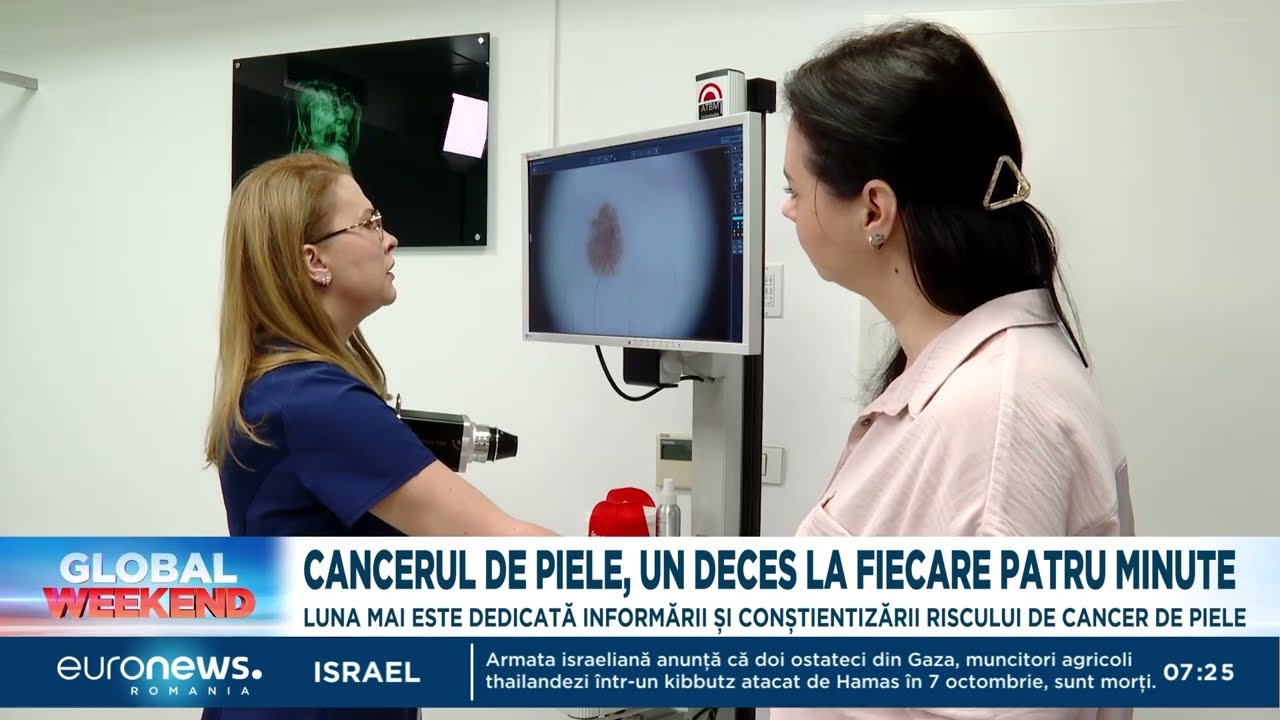 Cancerul de piele provoacă un deces la patru minute. Care sunt sfaturile specialiștilor