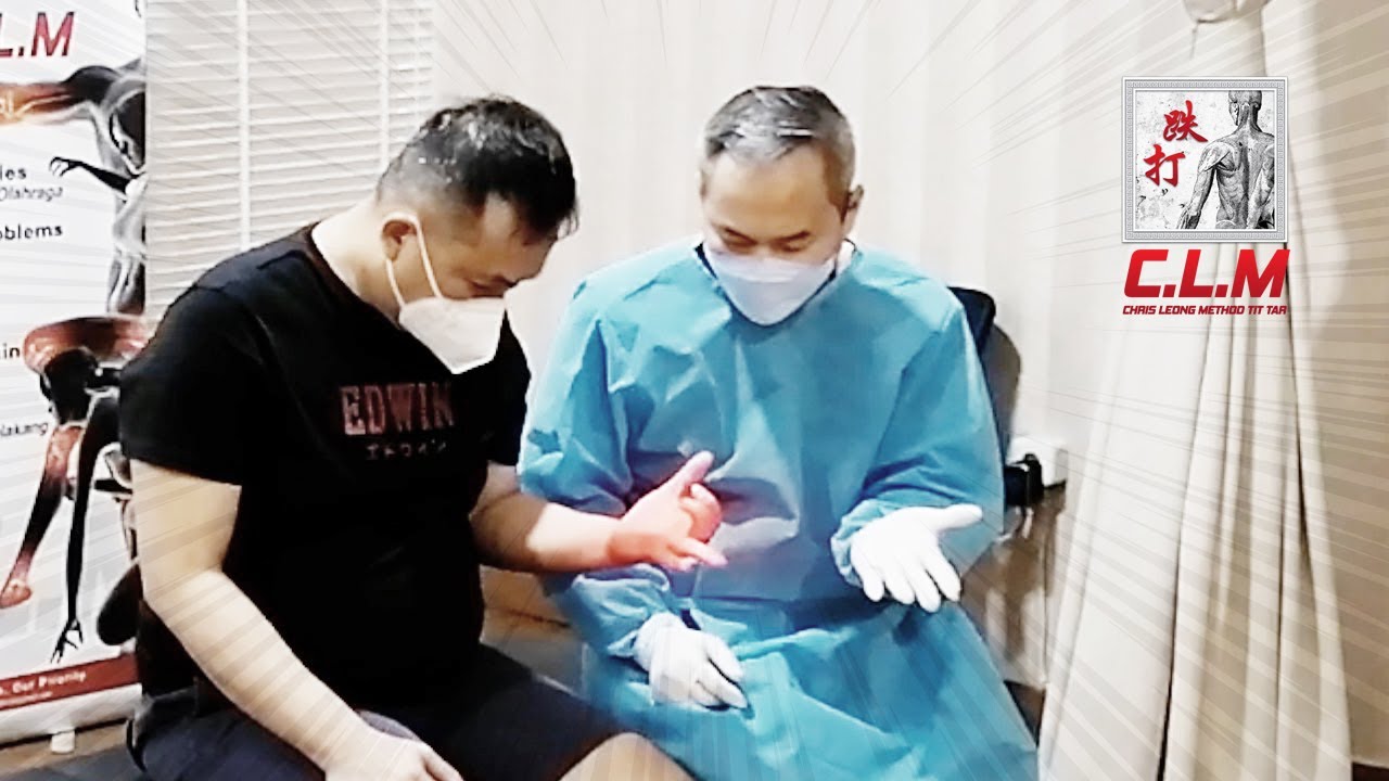 Radang sendi (trigger finger)