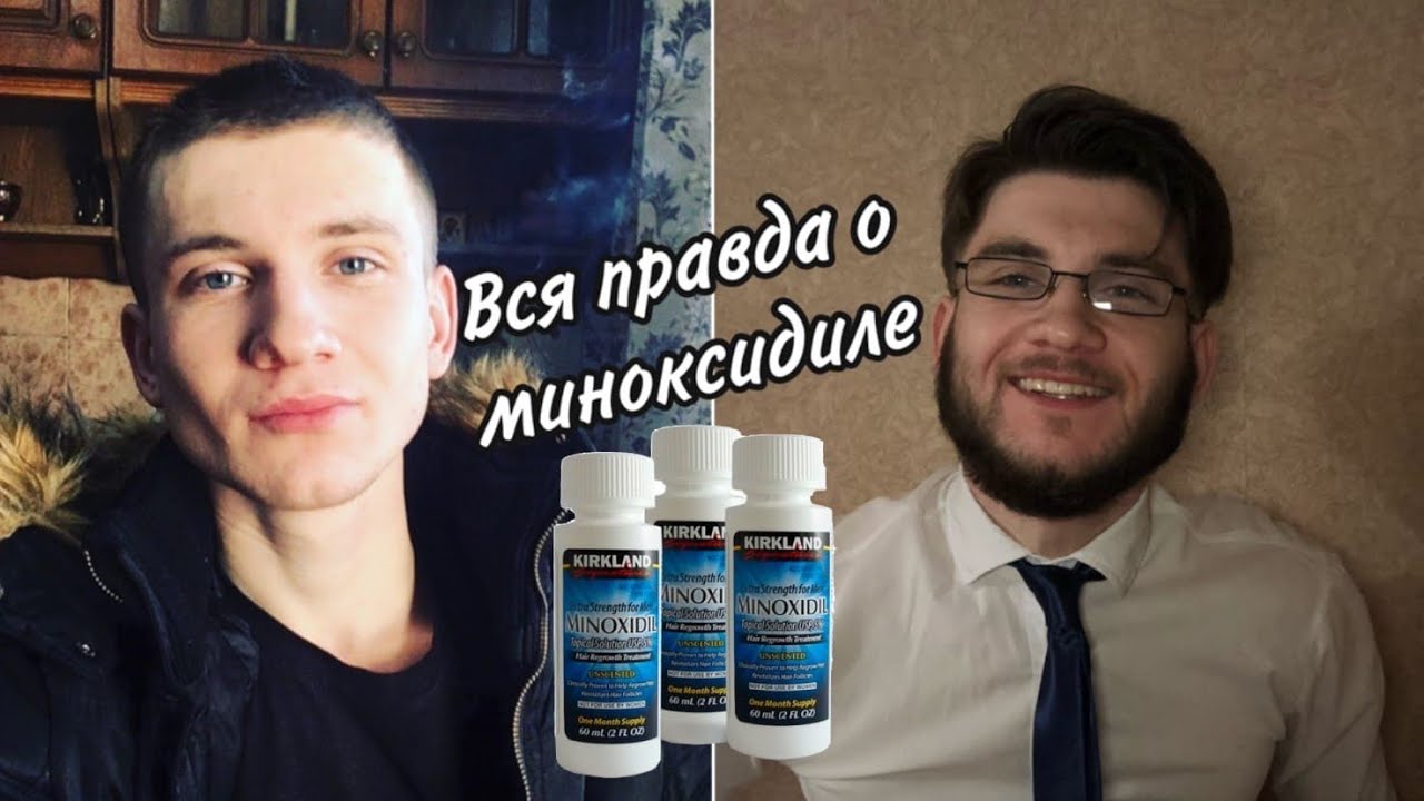 #КОЛЛИНЗГОВОРИТ: Вся правда о миноксидиле. Так вот почему...