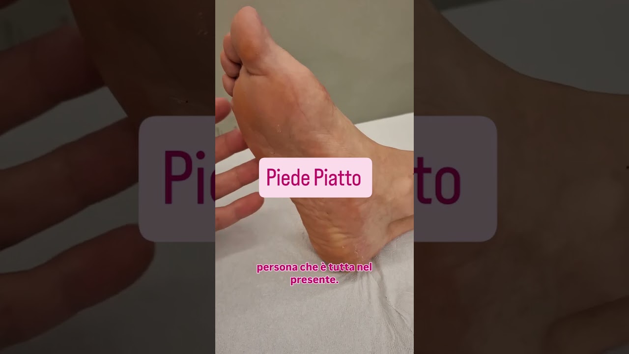 piede piatto
