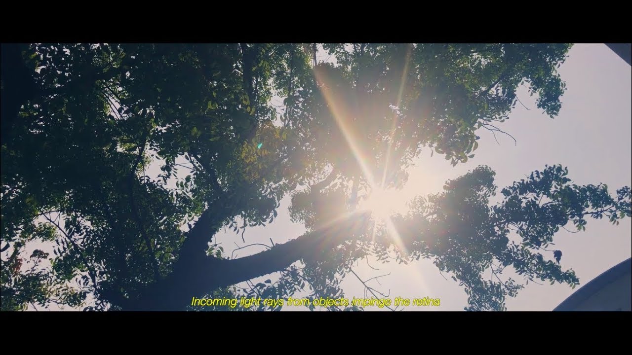 Akinetopsia