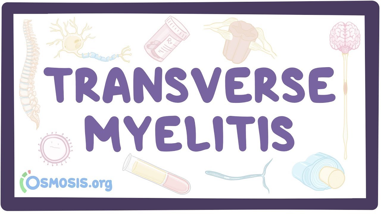 Transverse myelitis - an Osmosis Preview