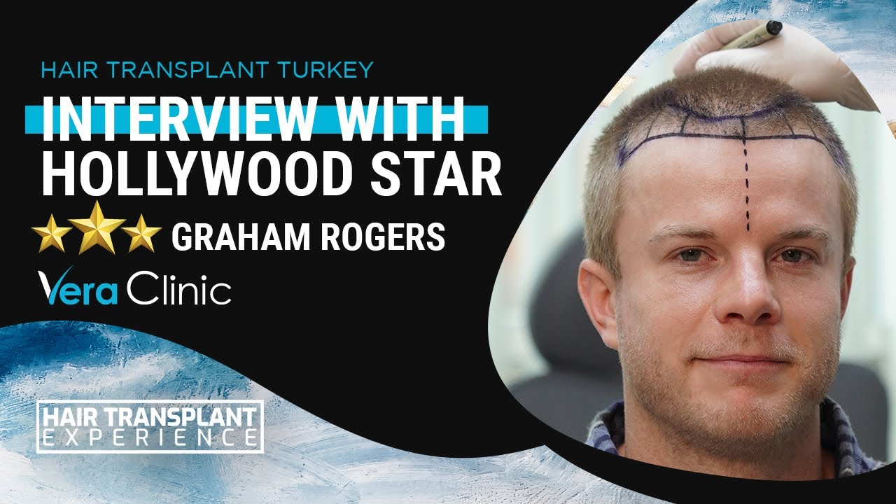 #hairtransplantturkey Interview with Hollywood Star Graham Rogers  #hairtransplant #veraclinic