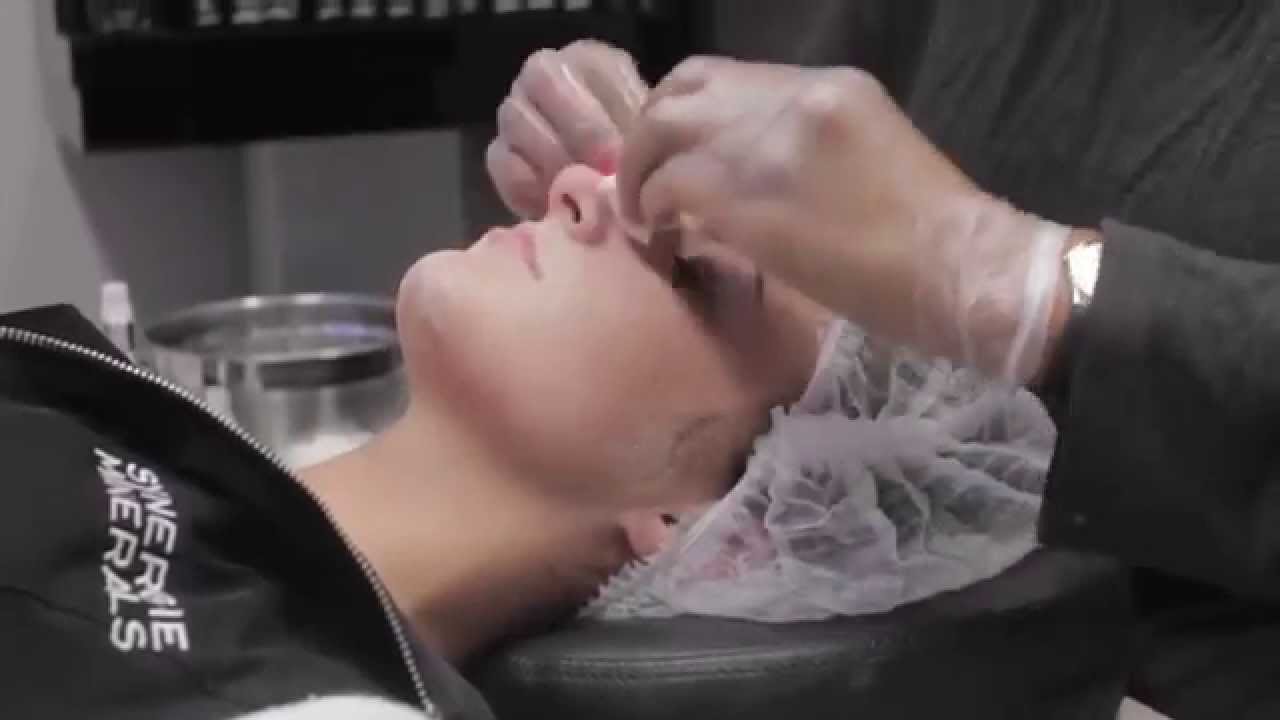 Skin Treatments - Jessner Power Peel (HD)