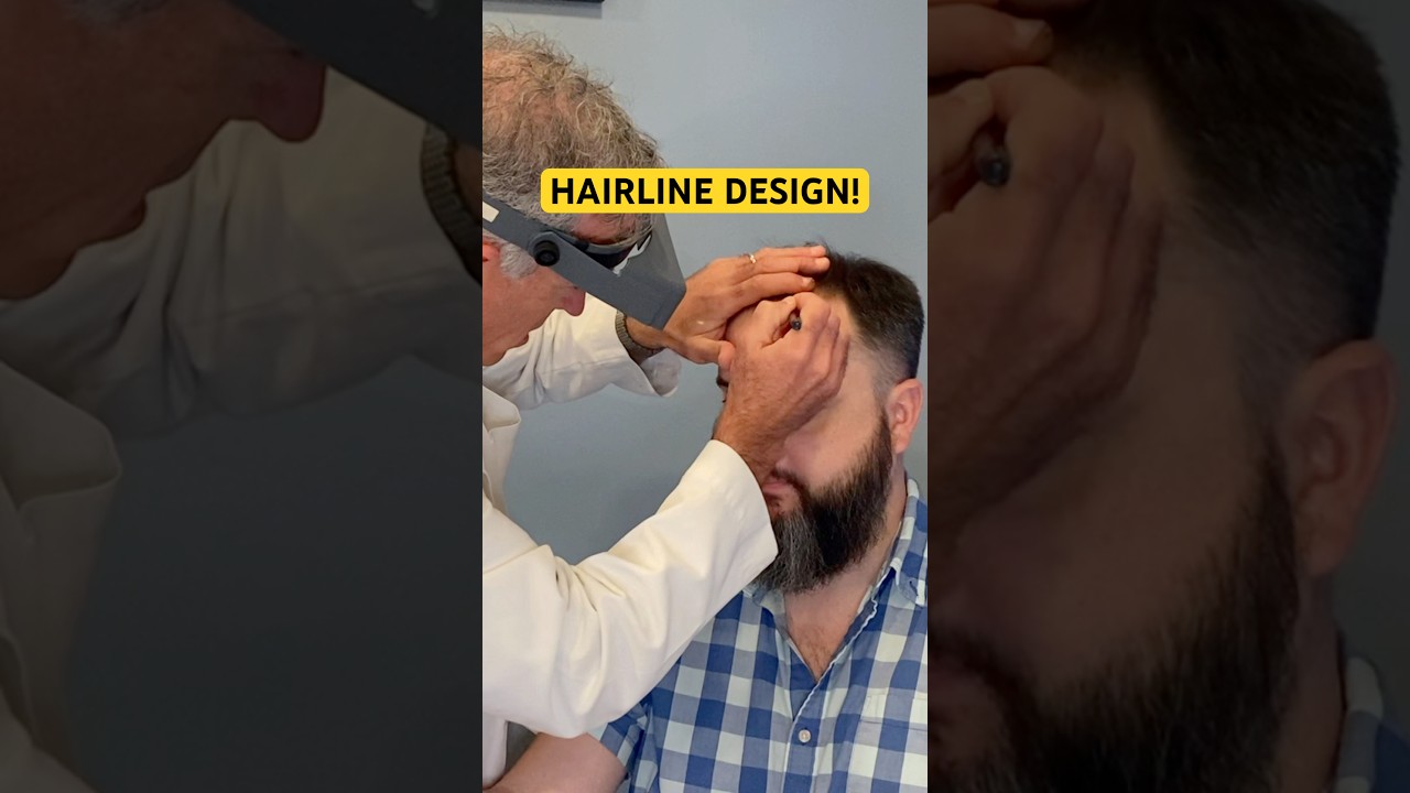 How a Hair Transplant Surgeon Designs a NATURAL Hairline!