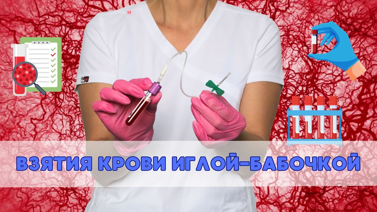 АЛГОРИТМ ВЗЯТИЯ КРОВИ ИГЛОЙ БАБОЧКОЙ