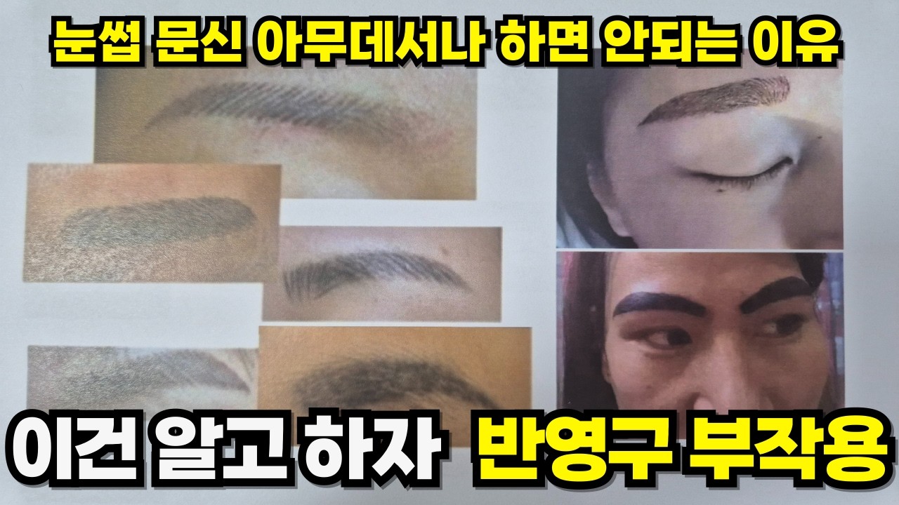 아무도 말해주지 않는 반영구 부작용