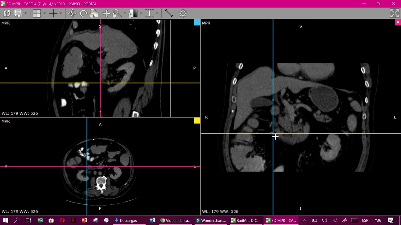 Tutorial funcionamiento RadiAnt DICOM lector de imágenes médicas para sistema operativo Windows