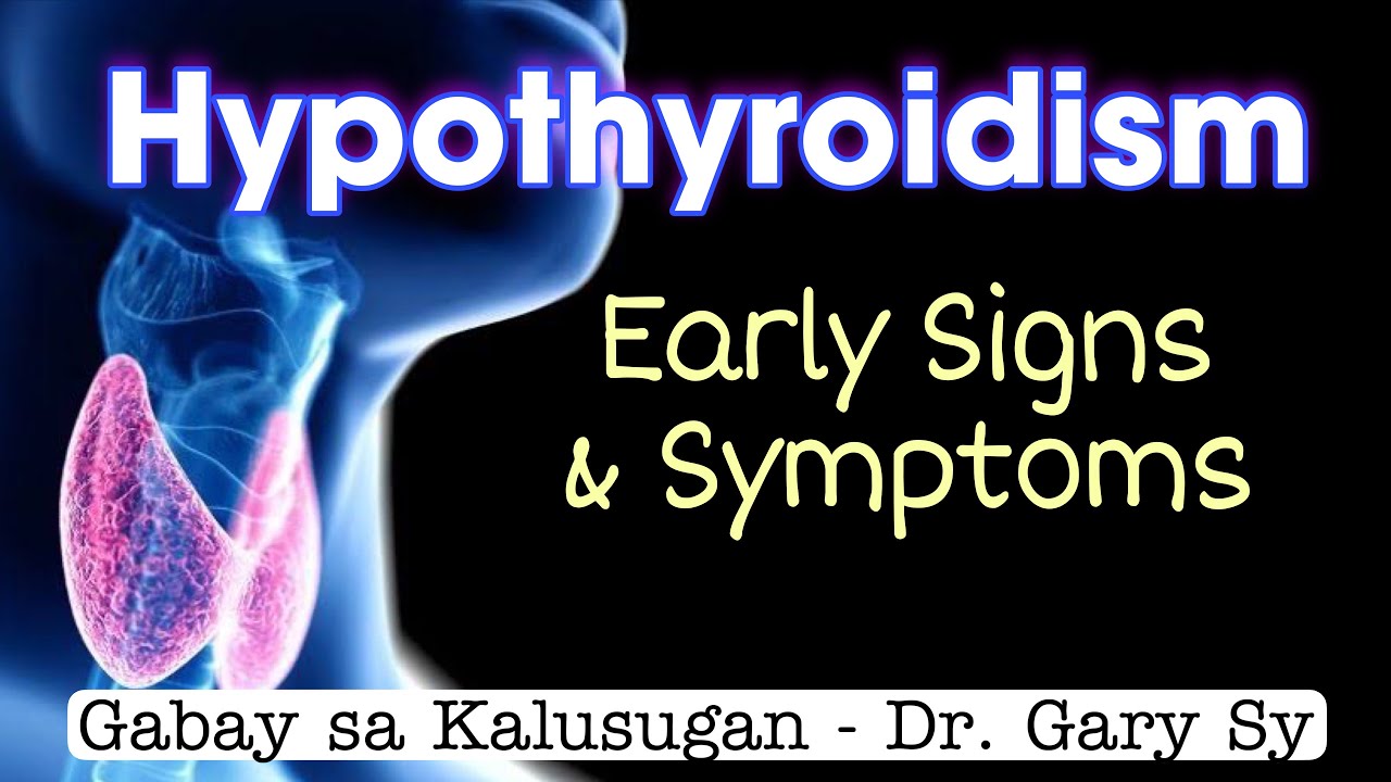 Hypothyroidism: Early Signs & Symptoms - Dr. Gary Sy
