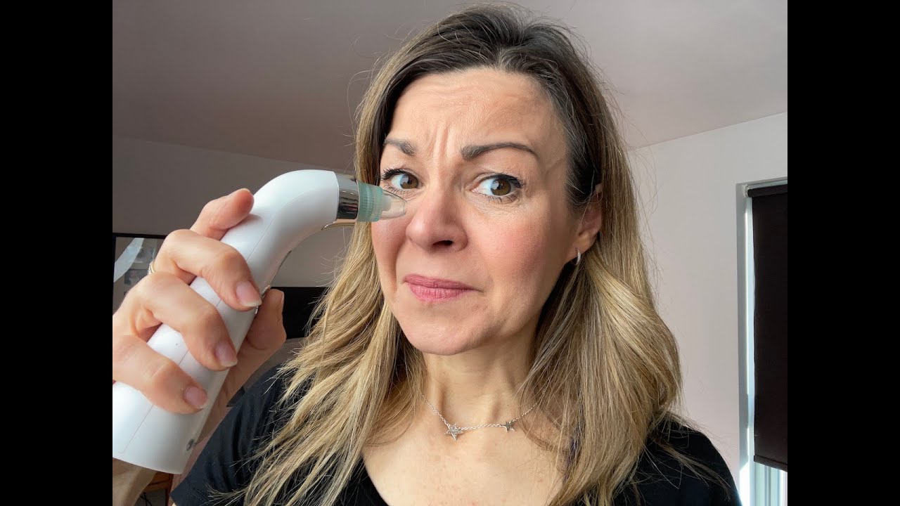 Review: Do blackhead remover vacuums work and are they a good idea?